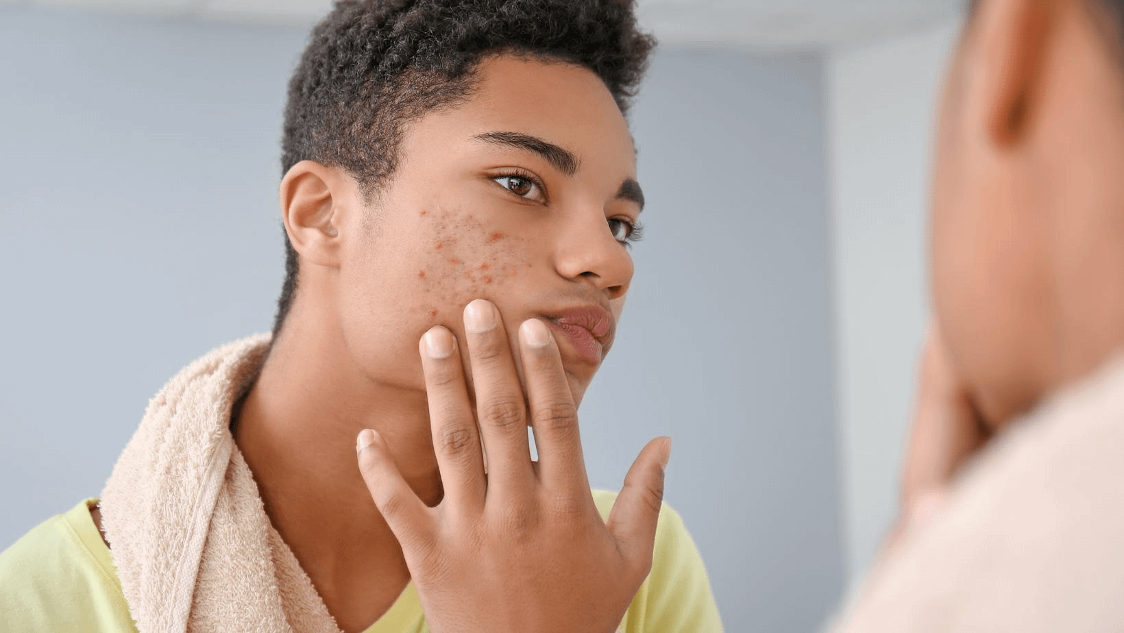 types-d'acné